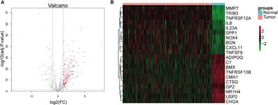 Immune-Related Prognostic Model in Colon Cancer: A Gene Expression-Based Study